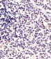 LCK Antibody
